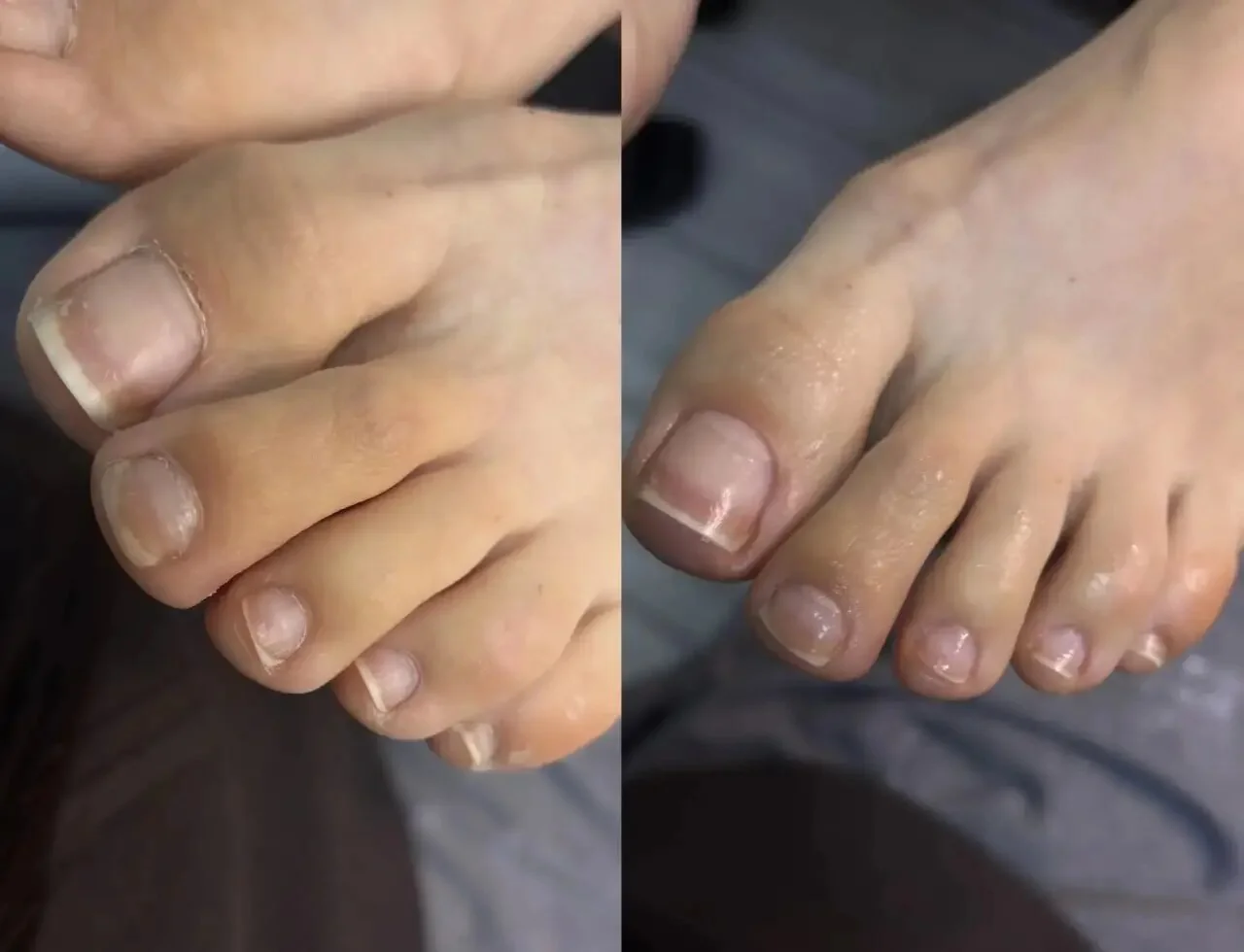 Педикюр Nails Bar в Белгороде - естественный педикюр без цветного покрытия - фото 41